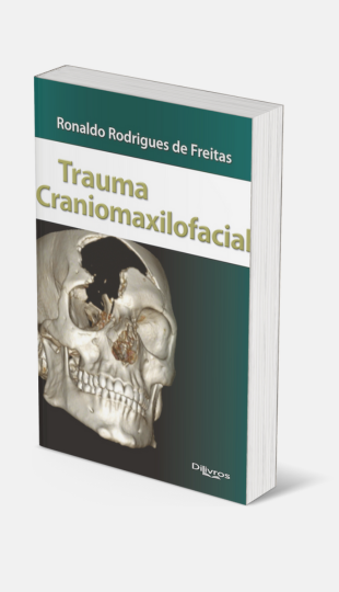 Trauma Craniomaxilofacial